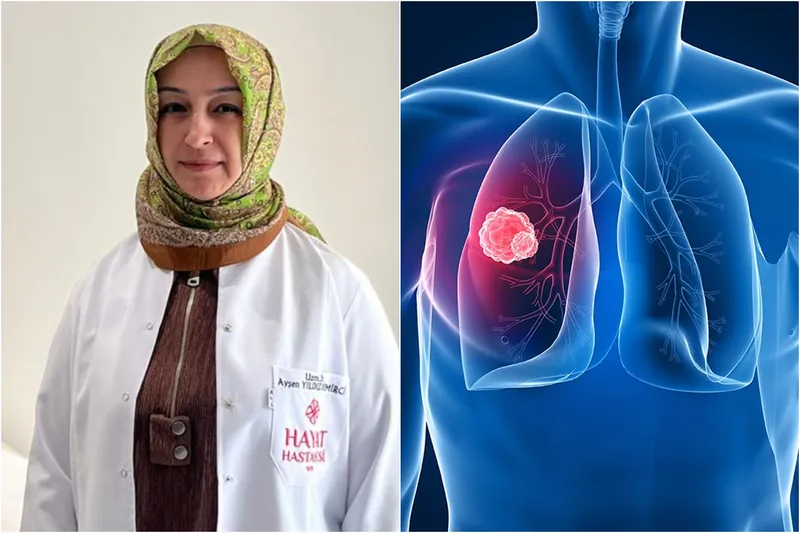 Uzman Dr. Demirci: Akciğer kanseriyle mücadelede erken teşhis en güçlü silahtır