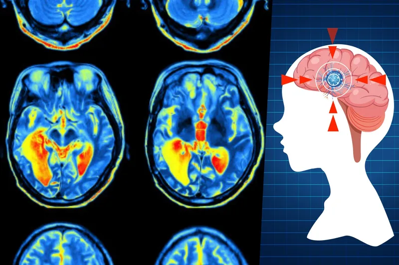 Bilim insanları beynin beş yaşam evresini belirledi: Kritik dönüm noktaları 9, 32, 66 ve 83 yaşında
